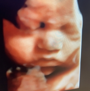 Hello Sweet Baby Ultrasound Houston and Shreveport