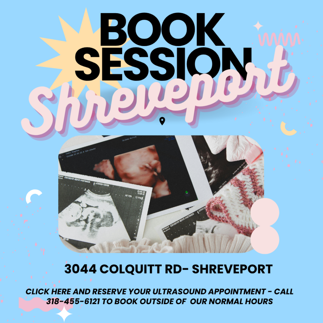 Elective Keepsake Ultrasound Studio Houston/Shreveport