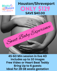 sweetbabyex.webp Elective Keepsake Ultrasound Studio Houston/Shreveport