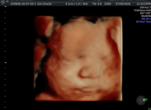 Hello-Sweet-Baby-Ultrasound-Houston-19.webp