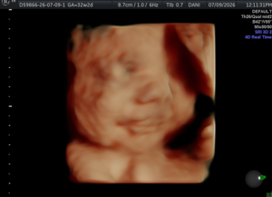 Hello-Sweet-Baby-Ultrasound-Houston-20.webp