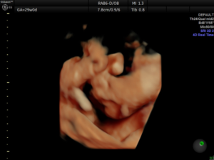 Hello-Sweet-Baby-Ultrasound-Houston-21.webp