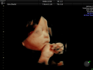 Hello-Sweet-Baby-Ultrasound-Houston-22.webp
