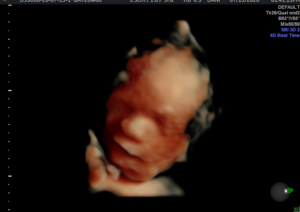Hello-Sweet-Baby-Ultrasound-Houston-24.webp