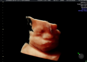 Hello-Sweet-Baby-Ultrasound-Houston-25.webp